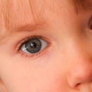 congiuntivite-allergica-bambini